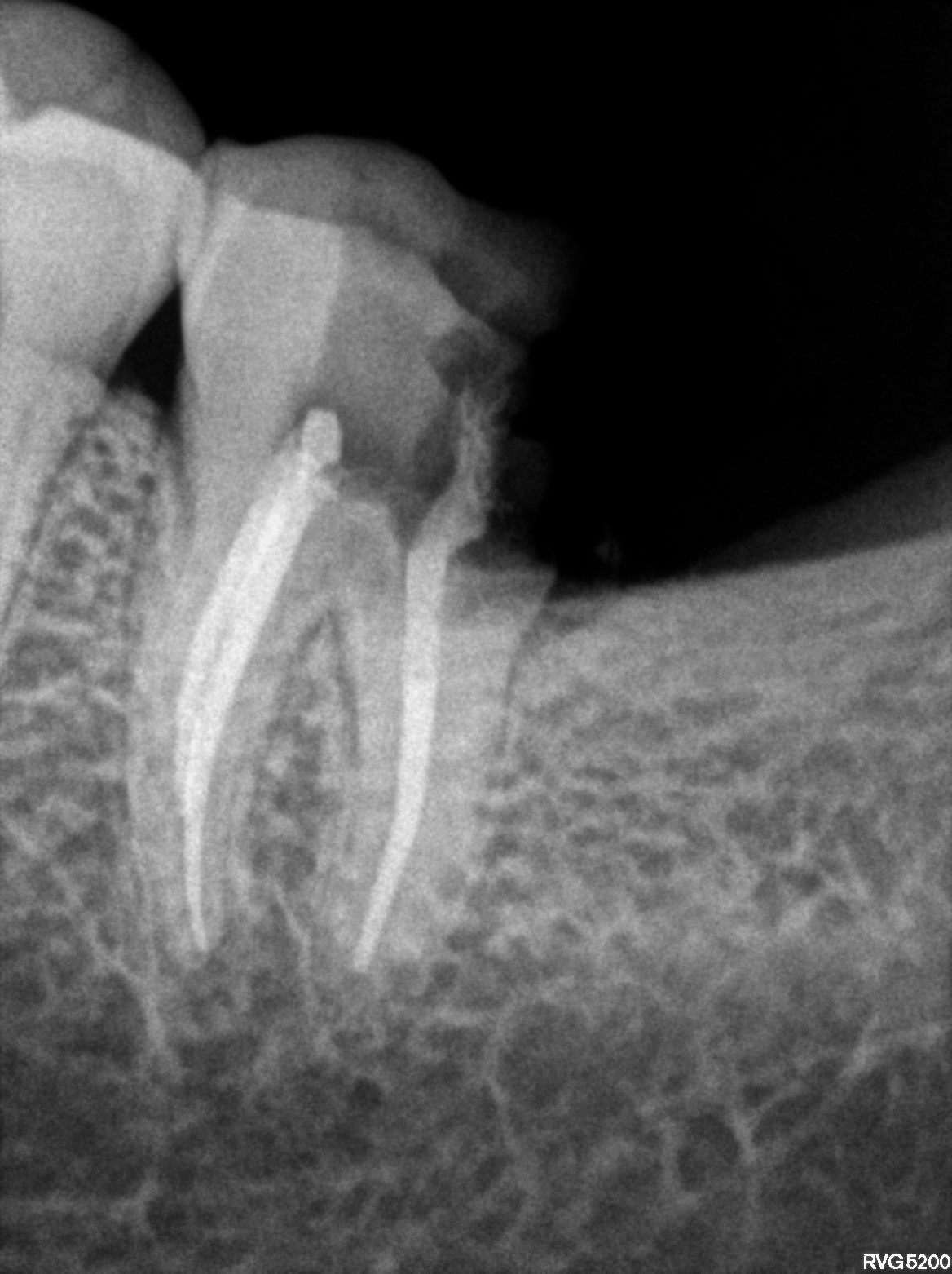 Dental X-ray